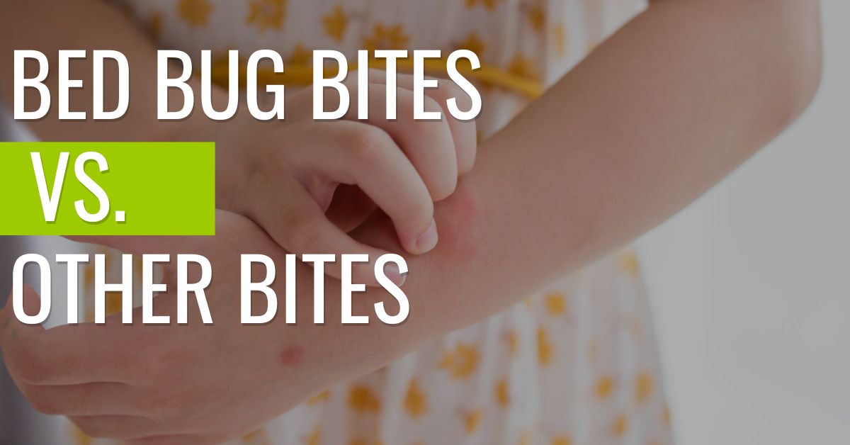 someone-scratching-bed-bug-bites