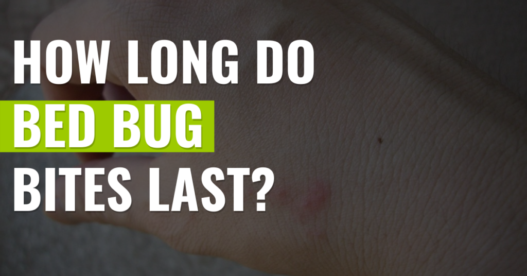 How-long-do-bed-bug-bites-last